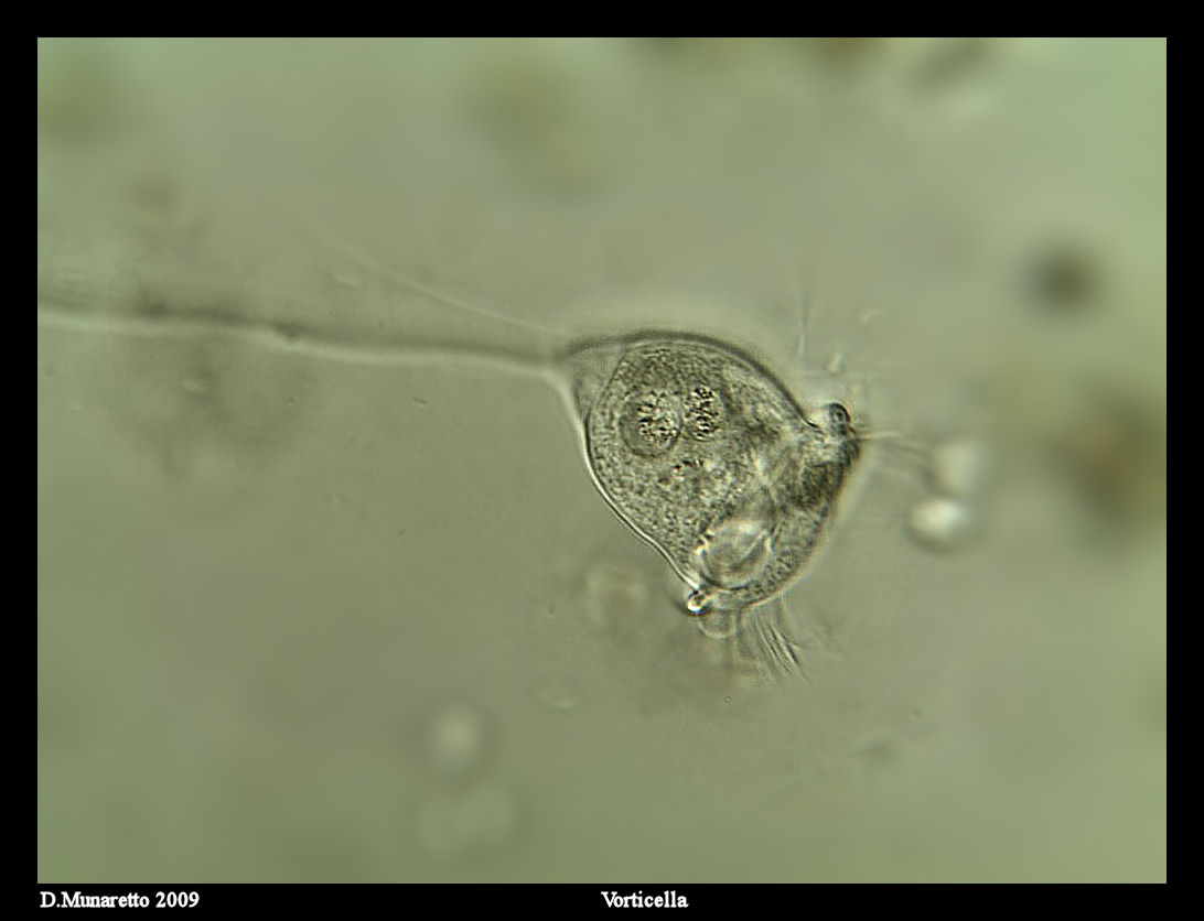 Vorticella...